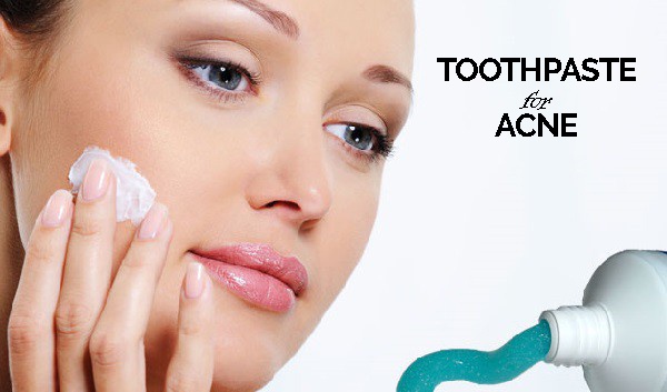 Women applying Toothpaste For Acne