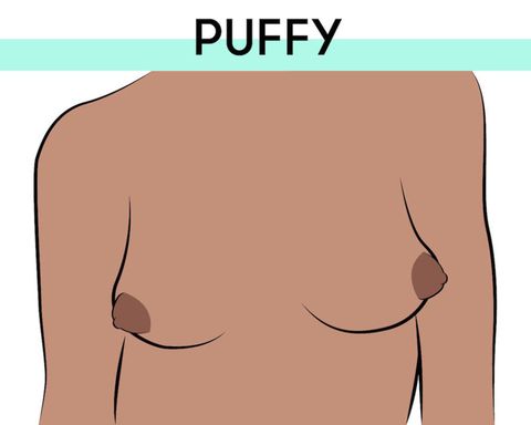 Everything You Ever Wanted to Know about Puffy Nipples