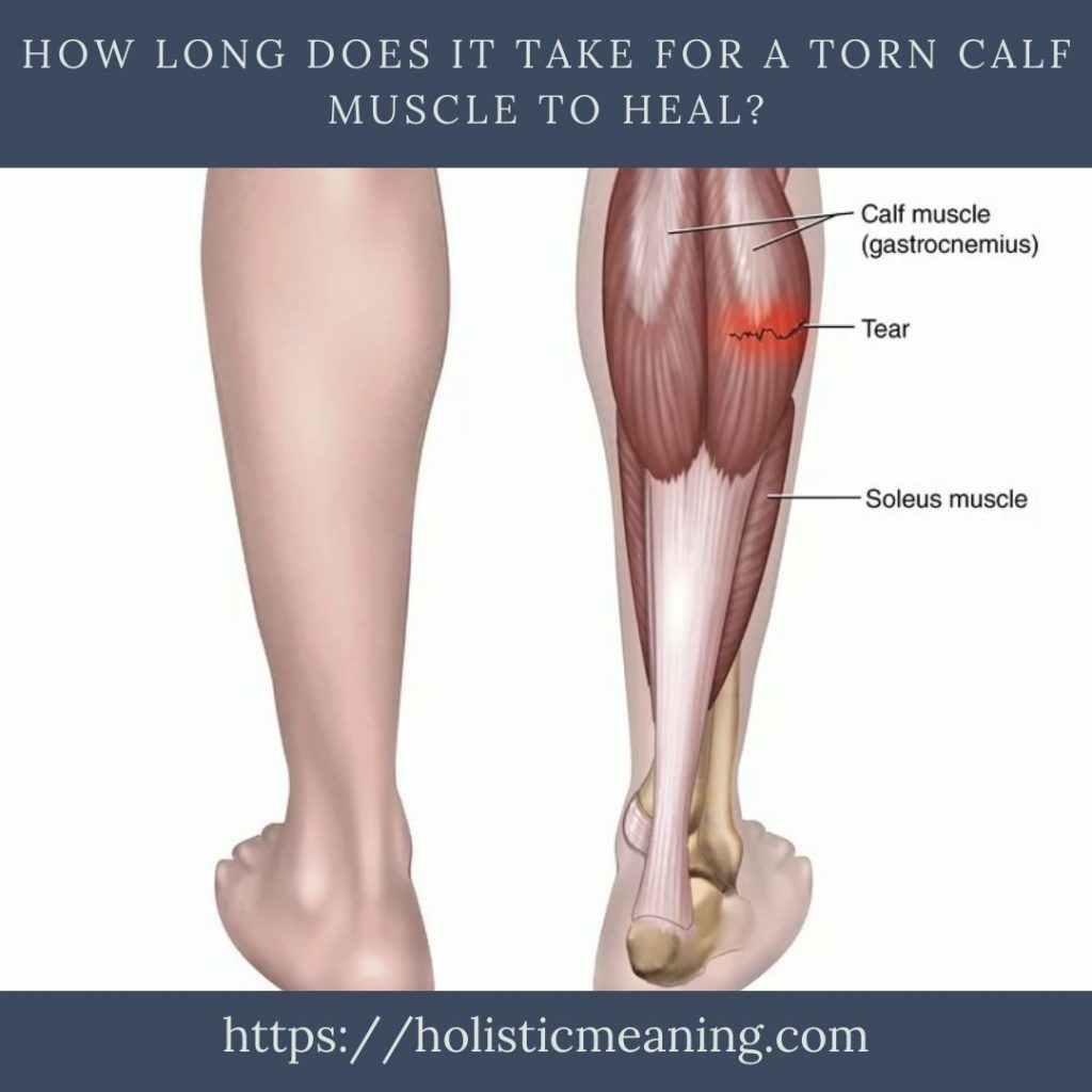 How Long Does It Take For A Torn Calf Muscle To Heal_